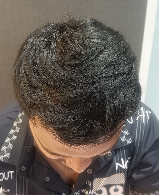 footer-gallery-image-3