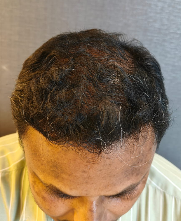 footer-gallery-image-2