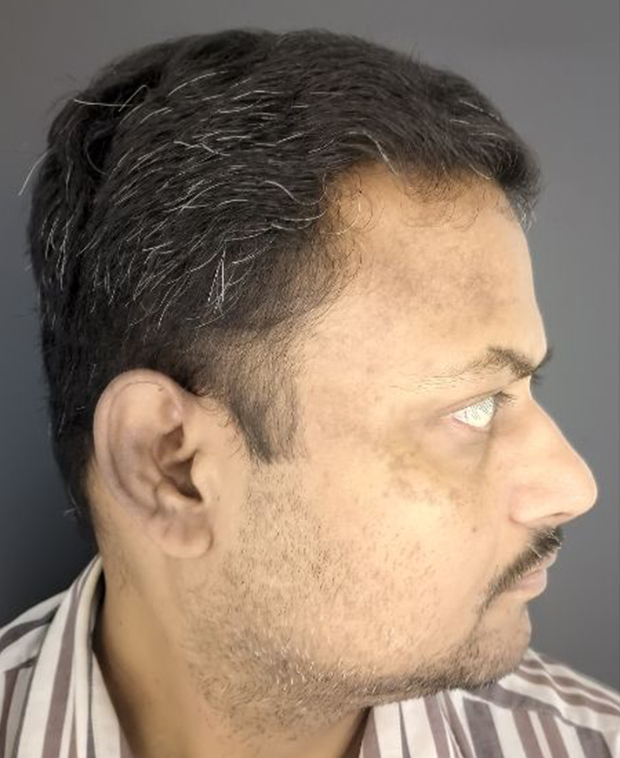 footer-gallery-image-4