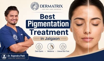 best-pigmentation-treatment-in-jalgaon-dermatrix-434x258-thumbnail-1786348851-203.webp
