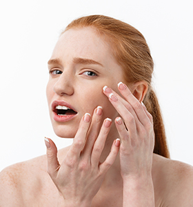 Acne Treatment