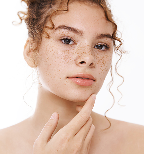 Pigmentation