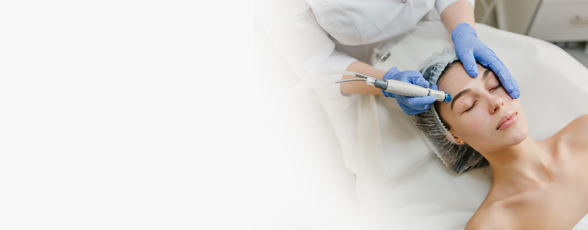 Laser Toning Treatment