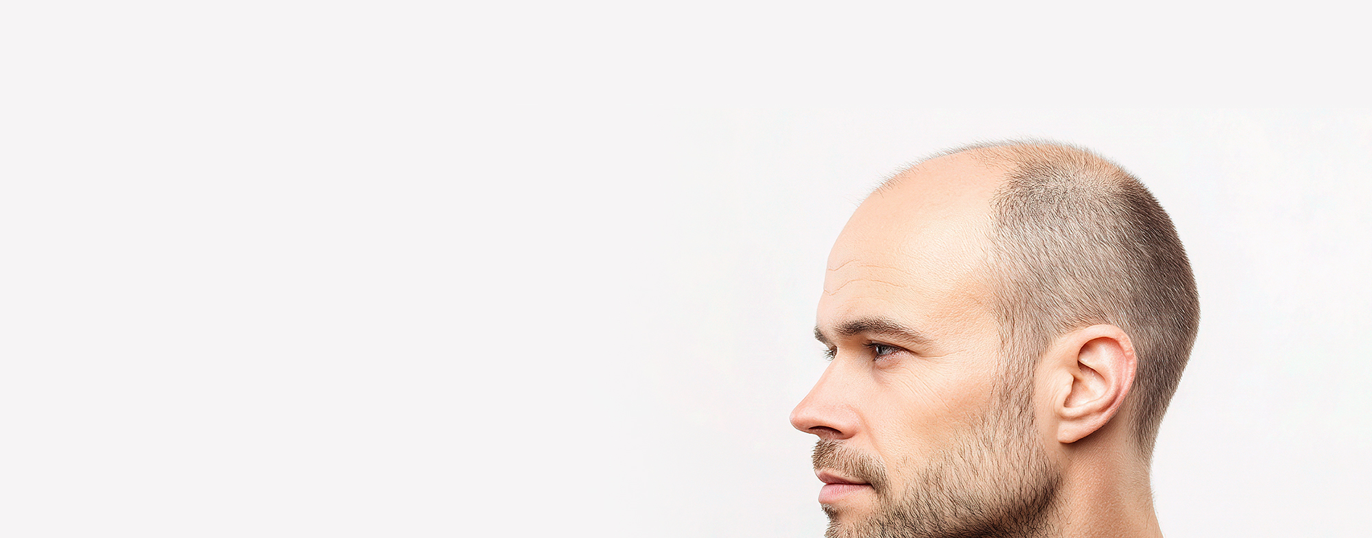 Exosome Hair Therapy