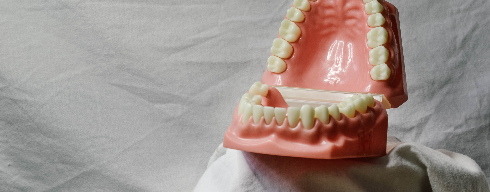 Wisdom Tooth Removal