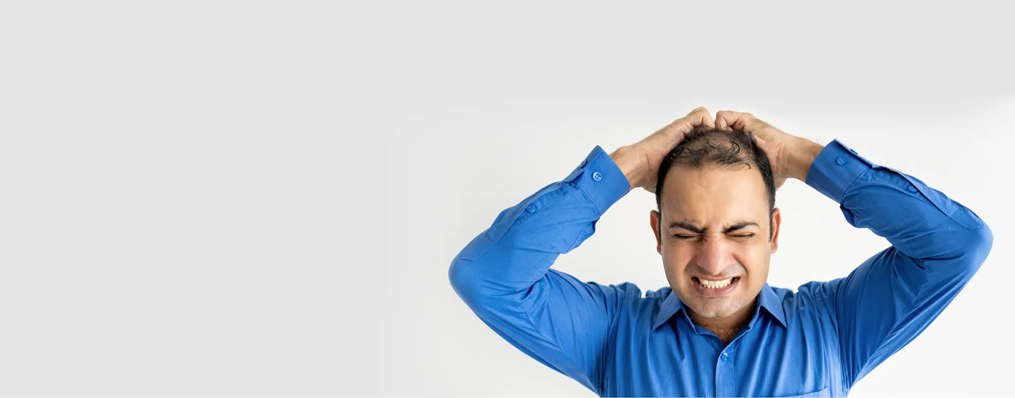 Man experiencing hair thinning and scalp hair loss 2000x785