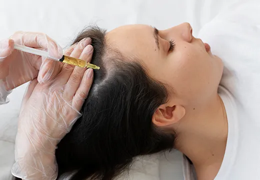 Dermatologist performing GFC hair treatment for hair growth and hair fall control 520x360