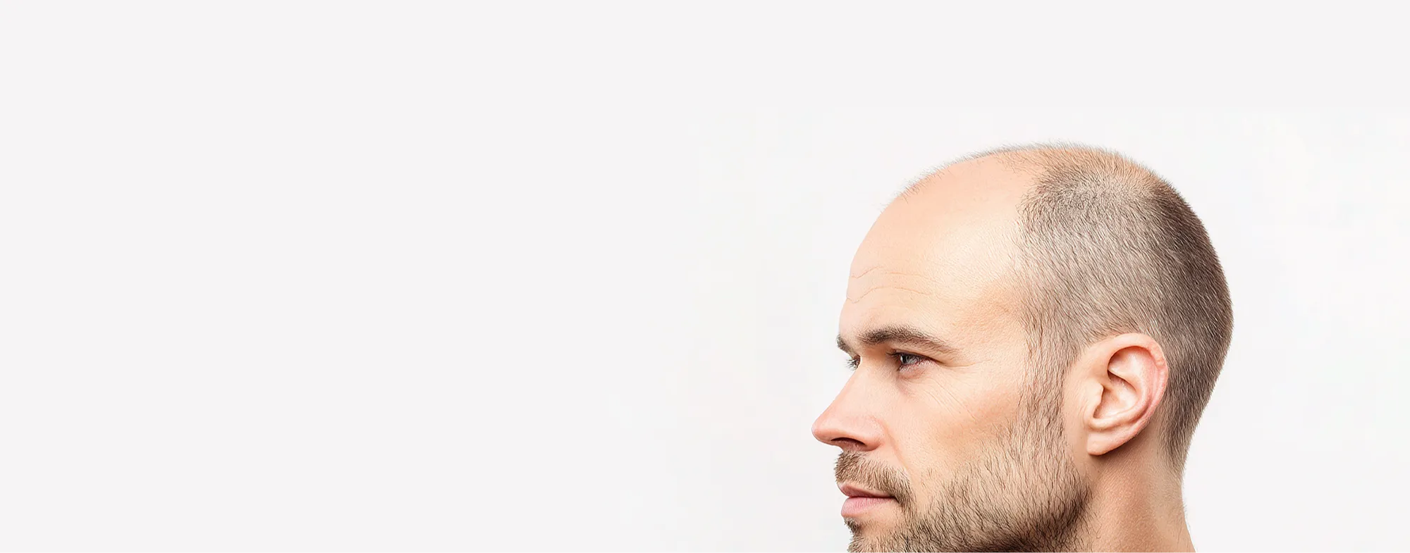 Exosome Hair Therapy for thinning hair and scalp restoration   Dermatrix 2000x785