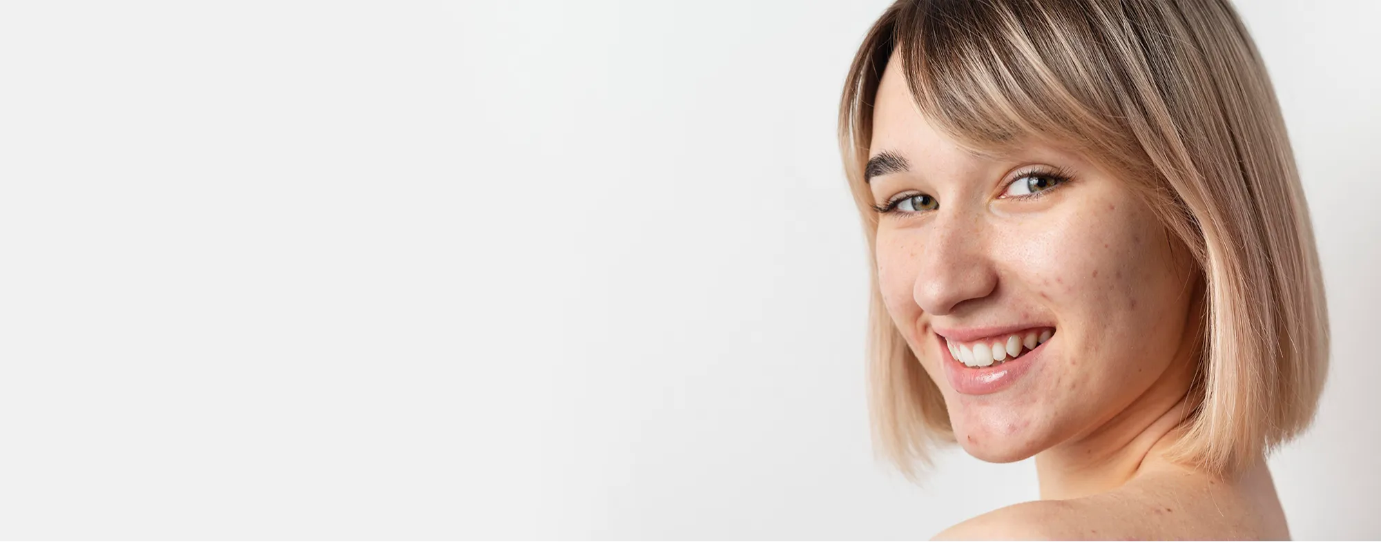 Smiling woman with clear skin representing successful acne scar treatment at Dermatrix clinic 2000x785