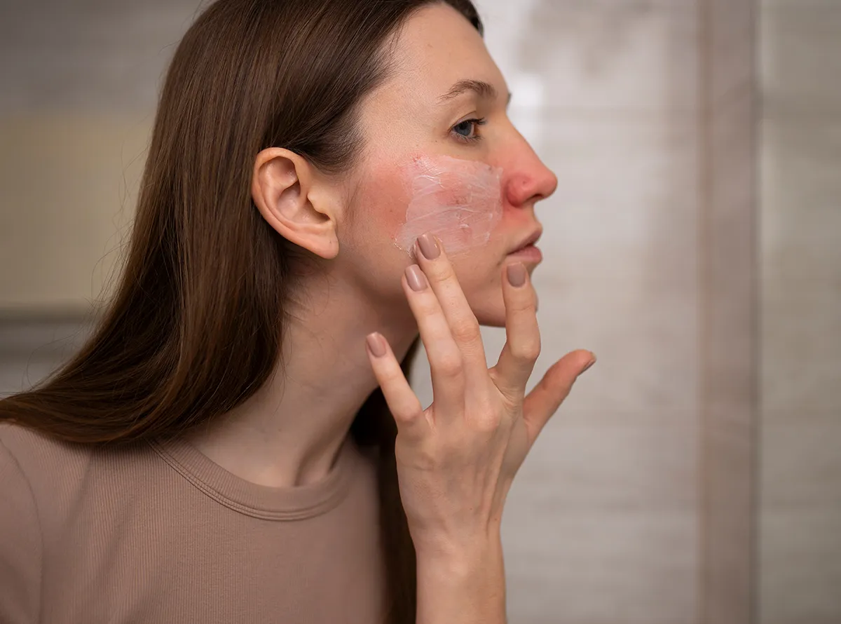 Dermatology patient with facial redness and skin irritation showing types of skin issues like acne scars and pigmentation 1200x890