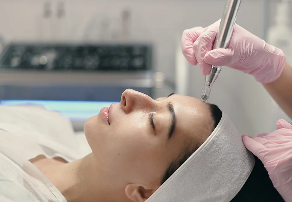 A person receiving a DermaFrac treatment, involving a handheld microneedling and serum infusion device applied to the forehead by a professional in pink gloves 1000x692