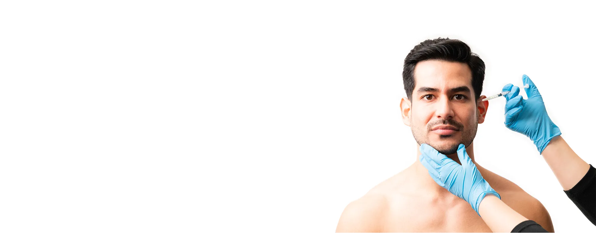 Promotional banner for Subcision Treatment at Dermatrix, showing a man receiving a dermatological procedure with a needle to treat depressed acne scars 2000x785