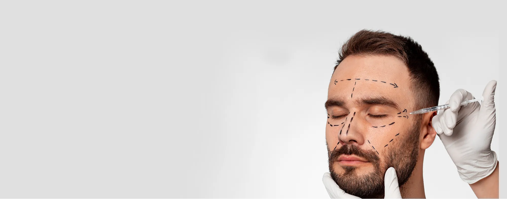 Dermatrix clinic banner for non surgical thread lifting services in Thane and Mumbai, featuring a man with facial markings for a cosmetic procedure 2000x785