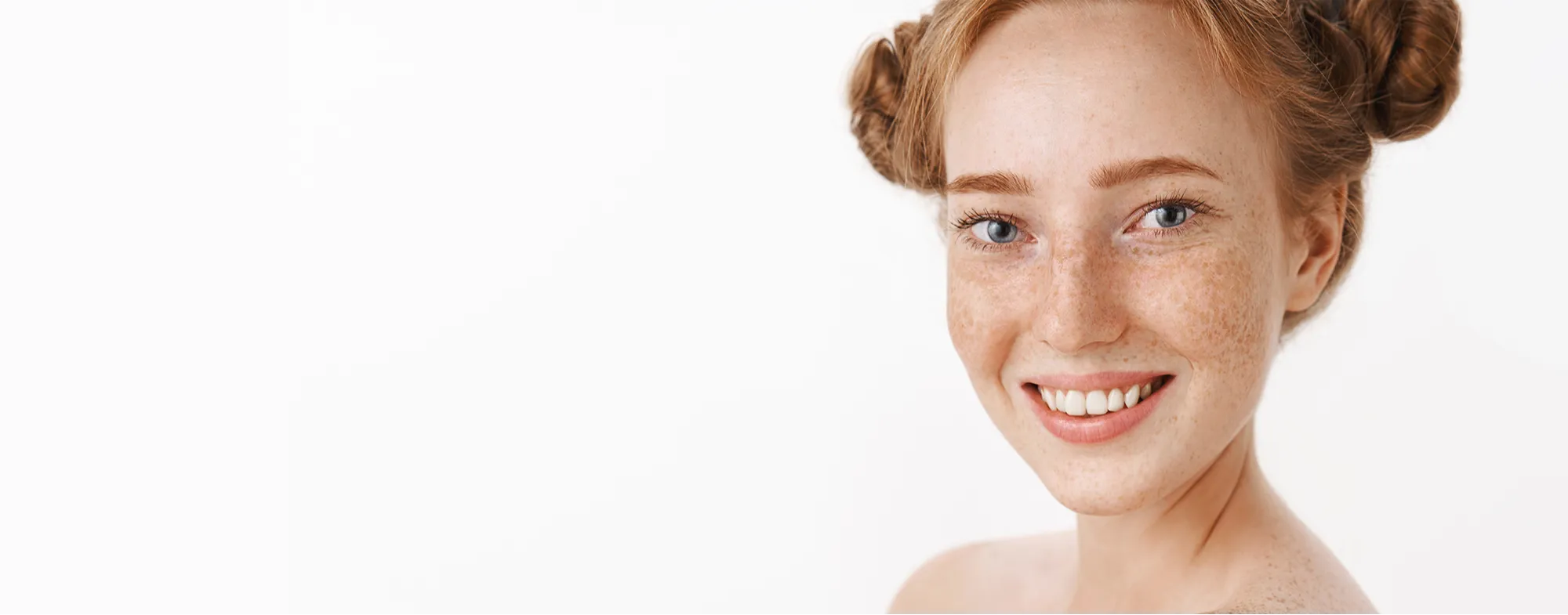 Freckle removal treatment at Dermatrix Clinic in Thane and Mumbai 2000x785