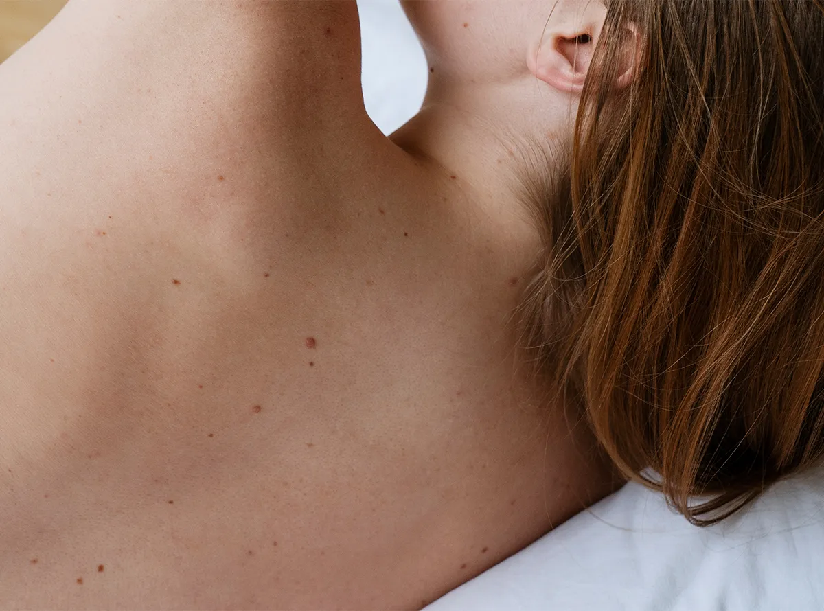 Dermatrix clinic skin tag removal services Thane and Mumbai 1200x890