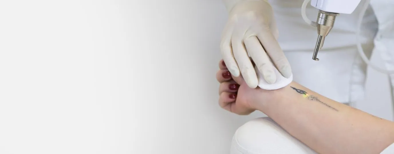 Dermatrix Clinic laser tattoo removal treatment in Thane and Mumbai 1376x540