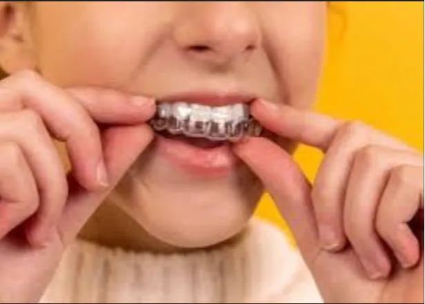 Ceramic braces and clear orthodontic aligners for teeth straightening at Dermatrix Clinic Thane and Mumbai 615x440