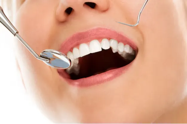 Full mouth reconstruction advanced dental procedures Dermatrix Clinic Thane West 626x417