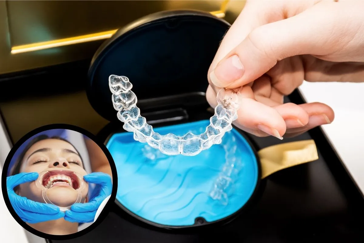 Best Invisalign Clinic in Mumbai and Thane   Dermatrix 1200x800