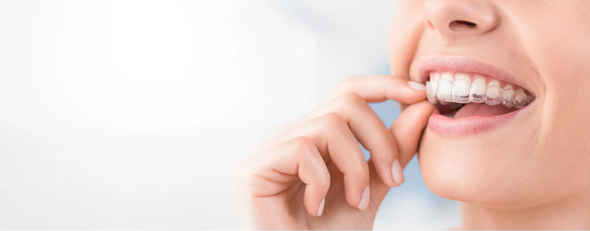 Invisalign Treatment at Dermatrix Clinic Thane and Mumbai 2000x785