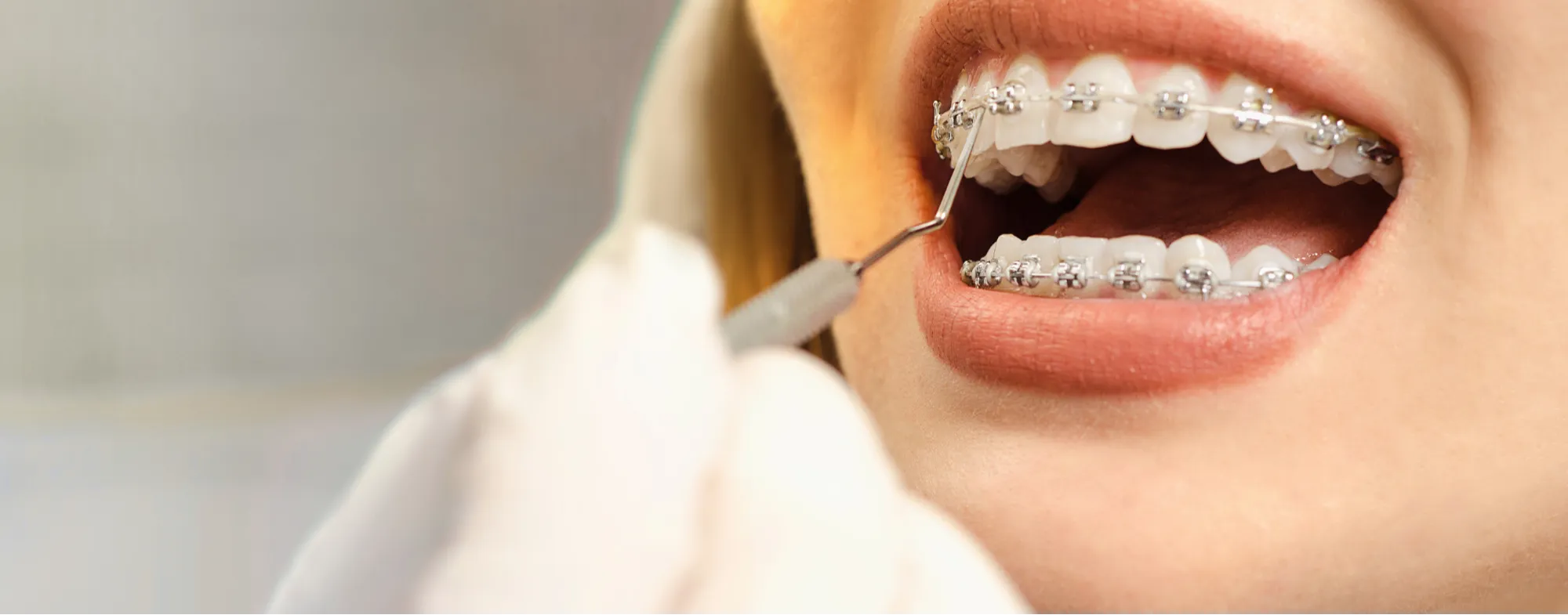 Smile Designing Treatment at Dermatrix Clinic in Thane and Mumbai 2000x785