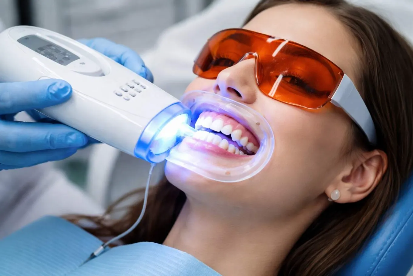 Professional cosmetic dental whitening by Dermatrix Clinic Mumbai