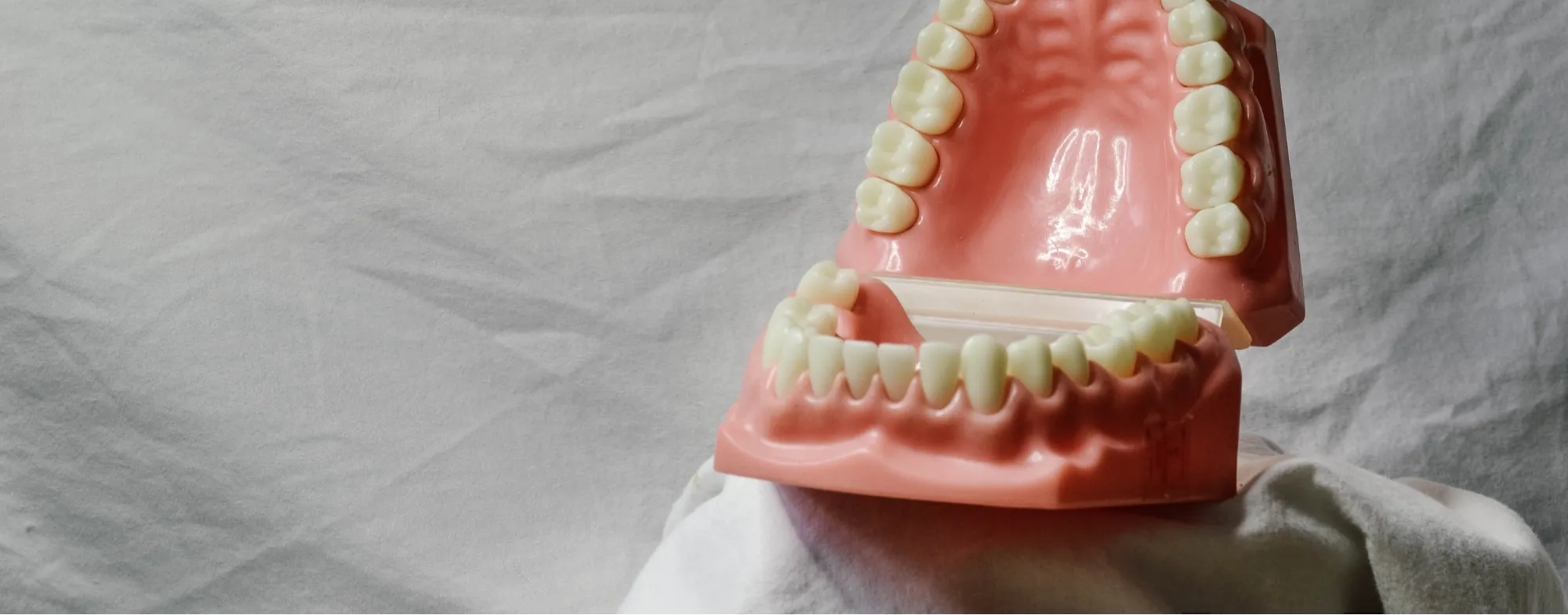 Wisdom tooth removal surgery at Dermatrix Clinic in Thane and Mumbai