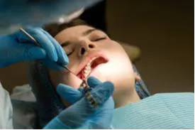 Dermatrix Clinic Thane and Mumbai   Professional third molar extraction and dental services