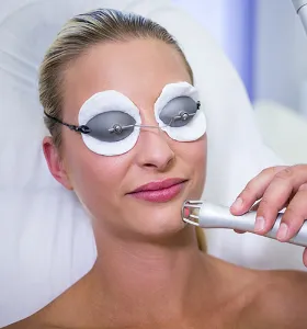 Fractional CO2 Laser Treatment 280x300