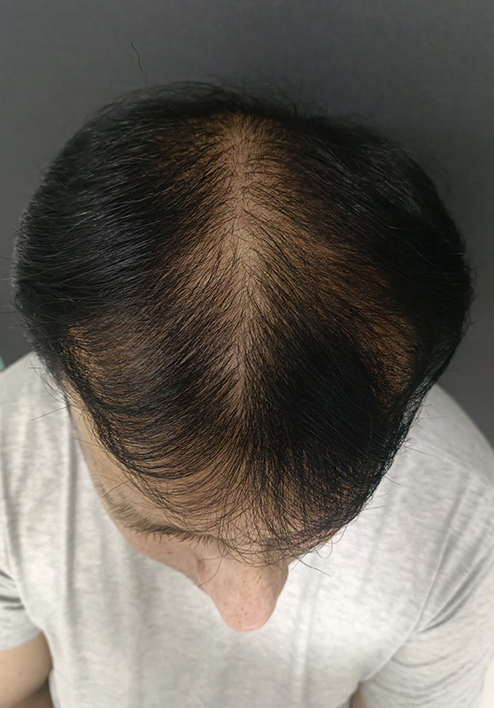 after
