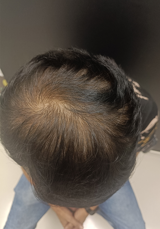 after