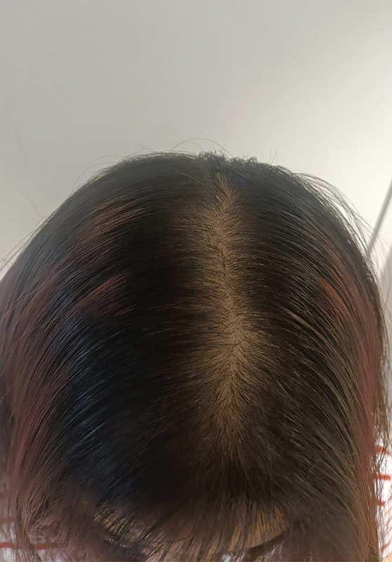after