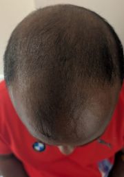 1780732123-175_after.jpg