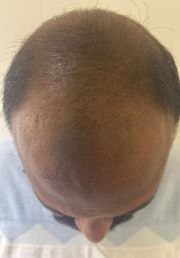 1780732123-854_before.jpg