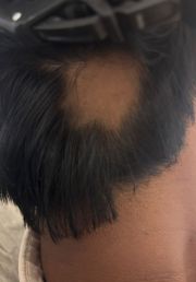 1780732331-748_before.jpg