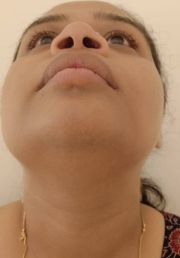1780734573-935_after.jpg