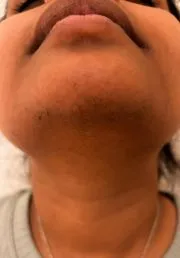1784013056-707_after.webp