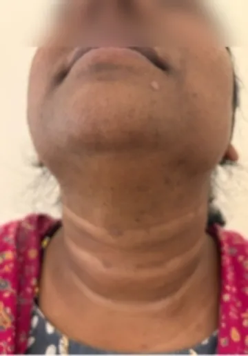 1784013457-884_after.webp