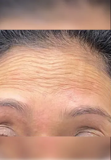 1784015997-594_before.webp