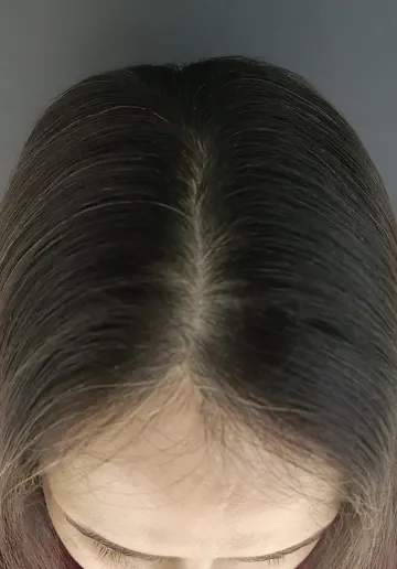 1784034400-295_after.webp