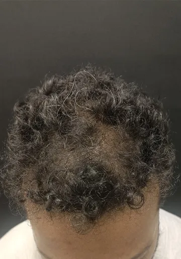 1784034531-178_before.webp