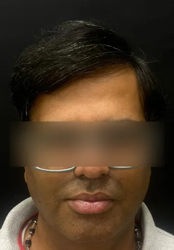 1784035219-739_after.webp