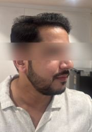 1787297711-631_after.jpg