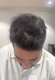 1787297761-925_after.jpg