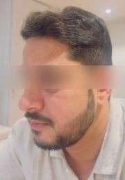 1787297795-509_after.jpg