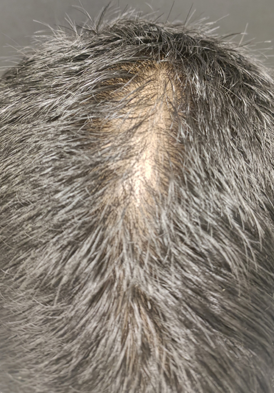 1756200996-905_before.jpg