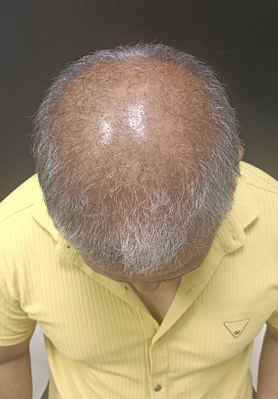 1756201277-929_before.jpg