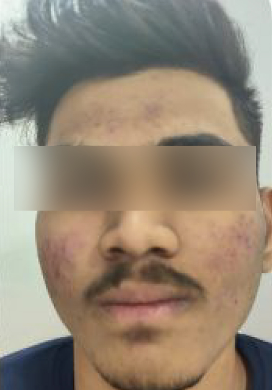 after
