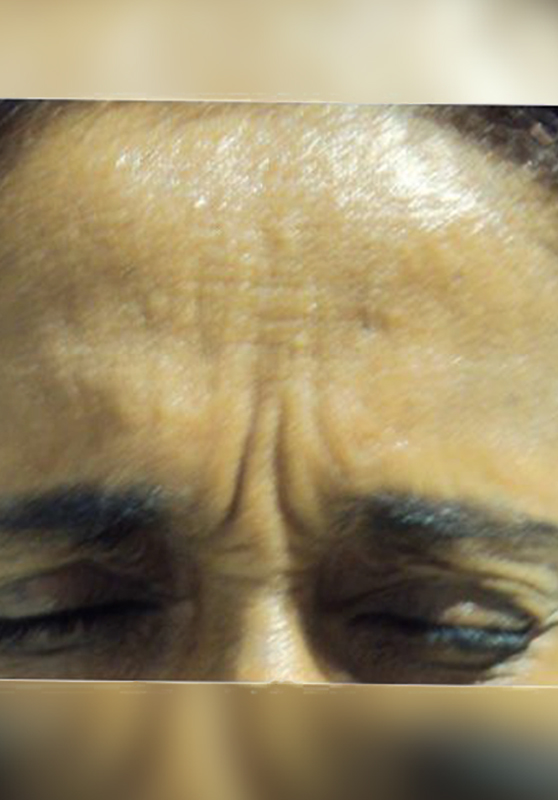 1758623116-961_before.jpg